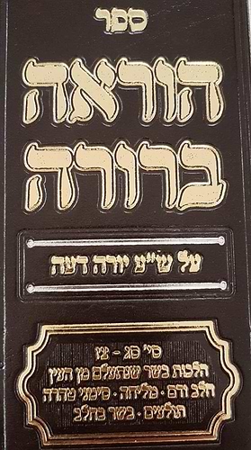 הוראה ברורה - בשר בחלב  