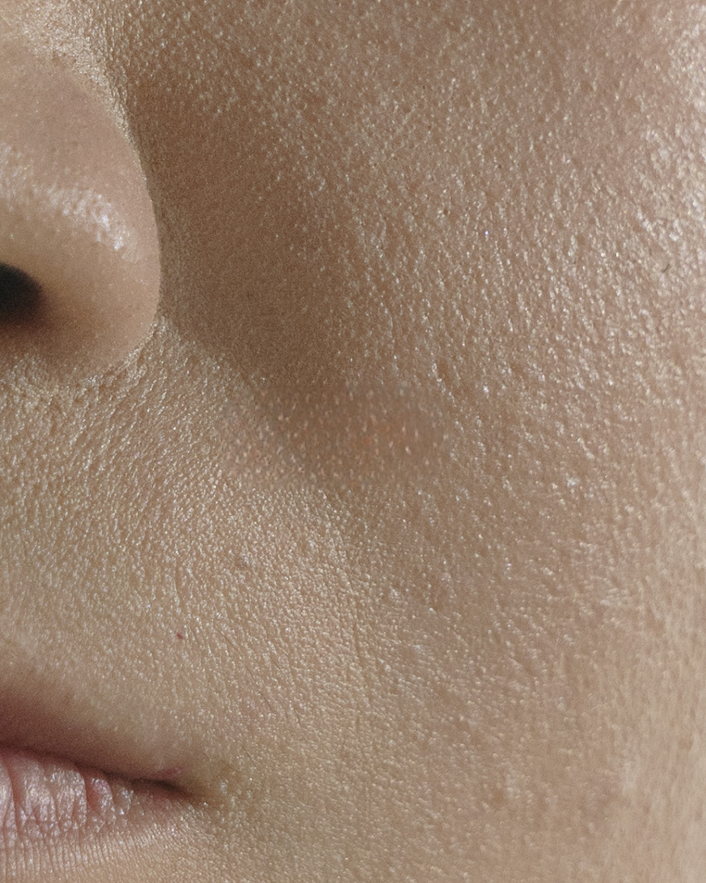 Causes pores dilatés.