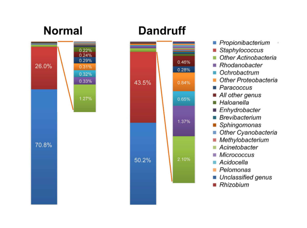 Distribution de la population bactérienne selon la présence ou l'absence de pellicules.