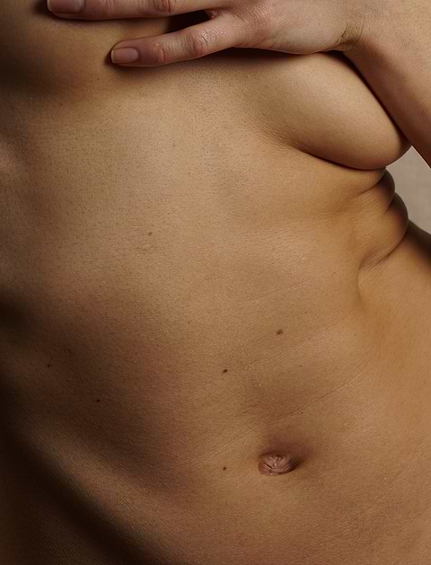 graisse revient après abdominoplastie.