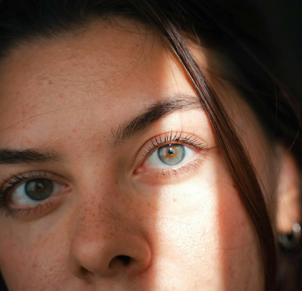 Effets de la vitamine C sur les cernes.