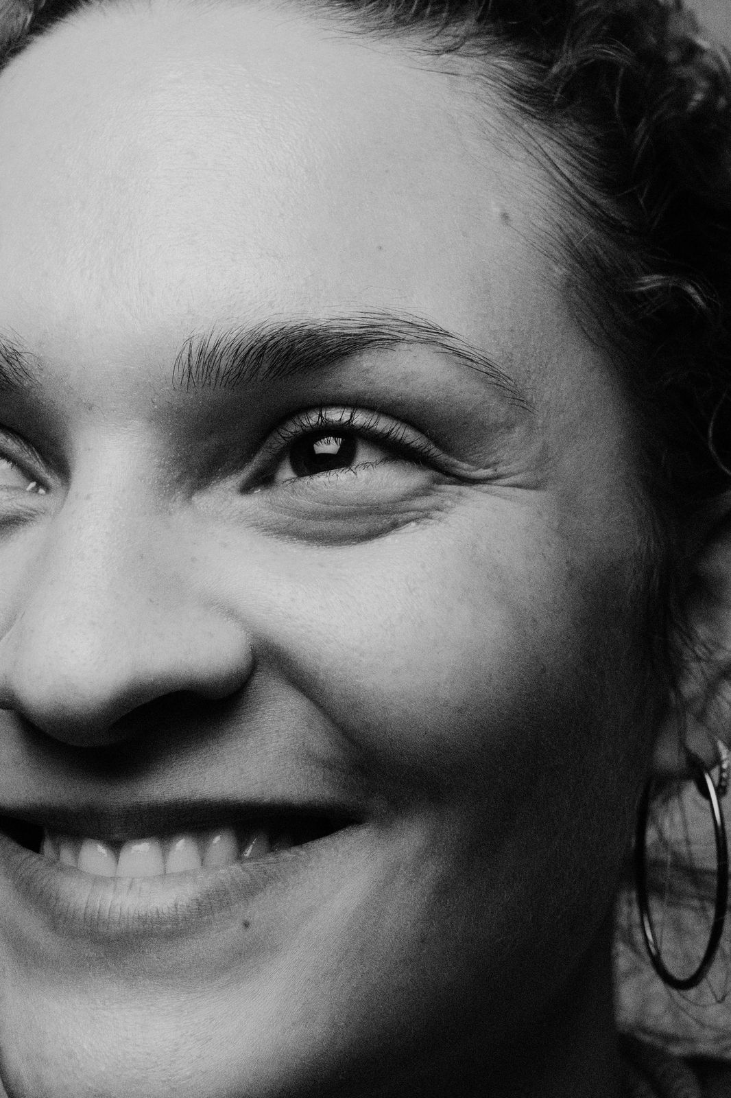 Les différents liftings du visage
