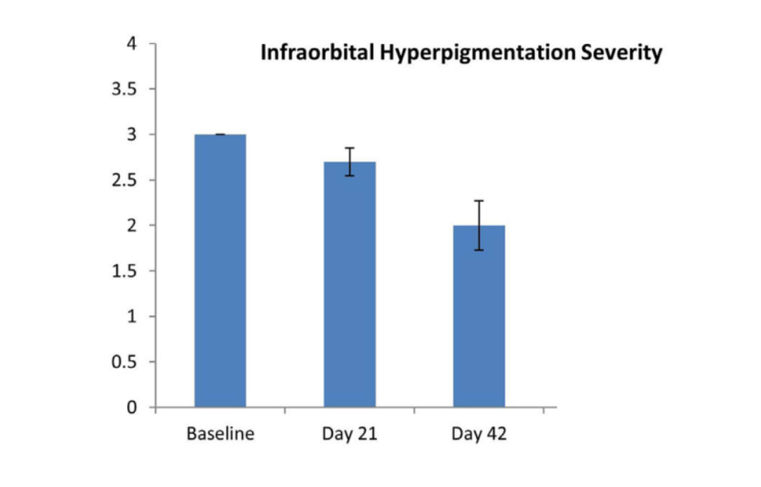 Efficacité du laser alexandrite 755 nm sur l'hyperpigmentation infra-orbitaire.