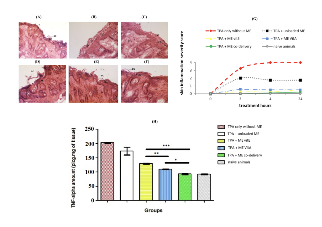 Analyses histologiques de la peau colorée par H&E dans la région dorsale des souris (A-F), score de gravité de l'inflammation cutanée (G) et niveaux de TNF-α dans le tissu cutané (H).