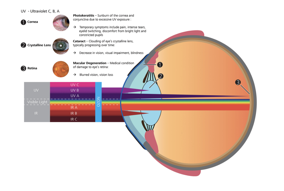 Les dangers du soleil pour les yeux.