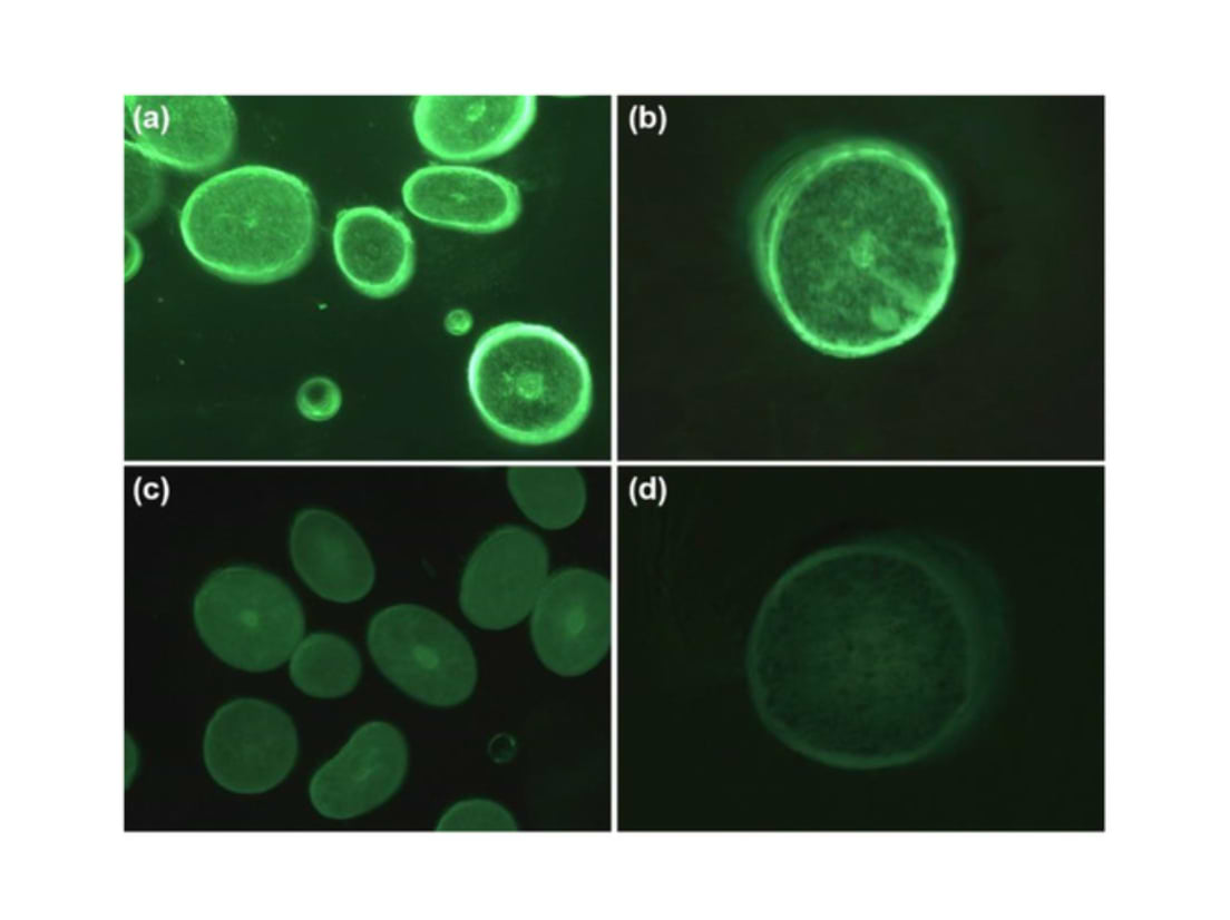 Coupes transversales de cheveux traités avec de l'acide hyaluronique de bas poids moléculaire (a, b) ou de haut poids moléculaire (c, d) marqué par fluorescence.