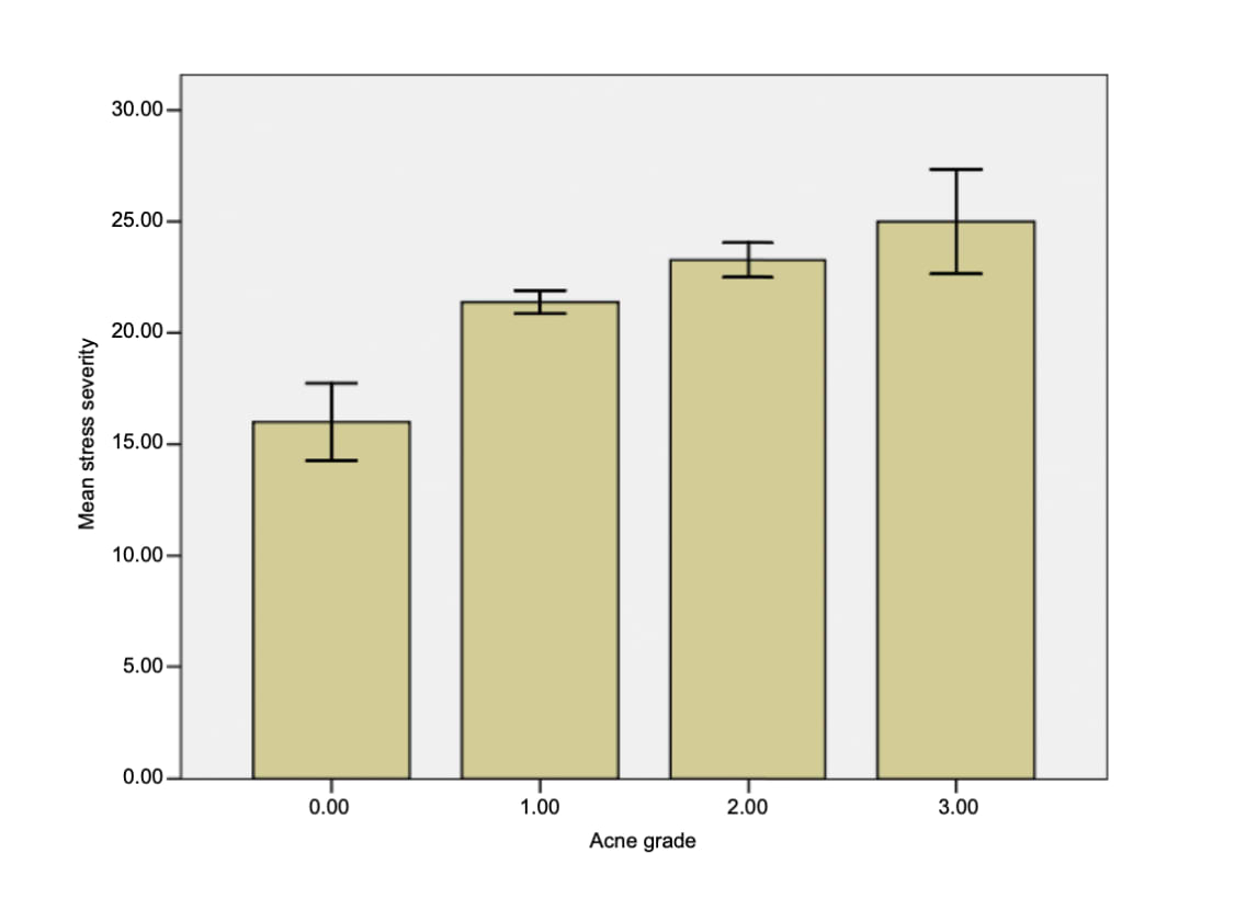 Relation entre l'intensité du stress et la sévérité de l'acné chez 144 étudiantes en médecine (0=pas d’acné ; 1=acné légère ; 2=acné modérée ; 3=acné sévère).