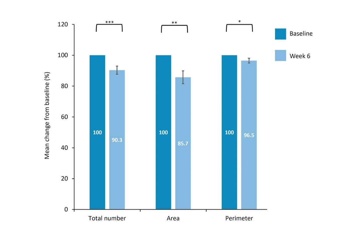 Efficacité de l'association acide azélaïque et acide tranéxamique sur l'hyperpigmentation.
