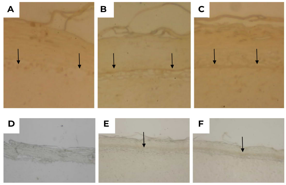 Source : CHAUDHURI R. K. & al. Bakuchiol: a retinol-like functional compound revealed by gene expression profiling and clinically proven to have anti-aging effects. International Journal of Cosmetic Science (2014).