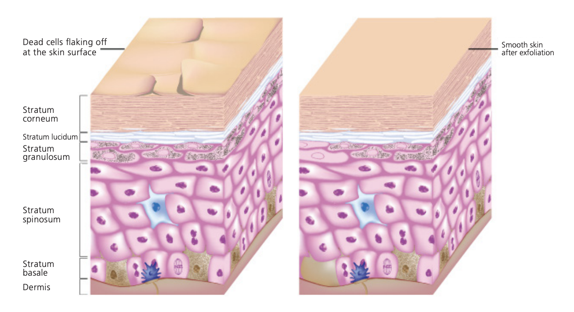 Modèle de peau non exfolié (à gauche) et exfolié (à droite).