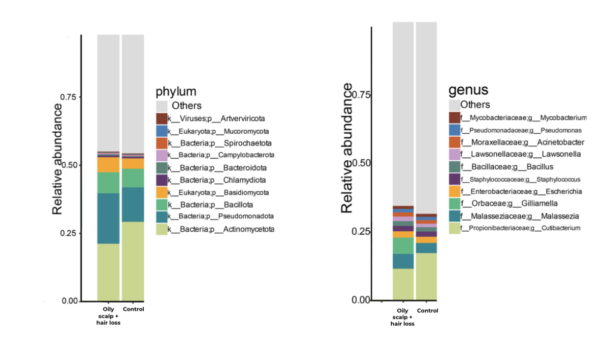 Différences dans le microbiome du cuir chevelu des jeunes femmes présentant un cuir chevelu gras et des pertes de cheveux comparées à un groupe contrôle.