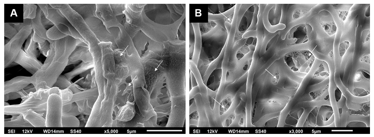 Microscopie électronique à balayage de biofilms fongiques.