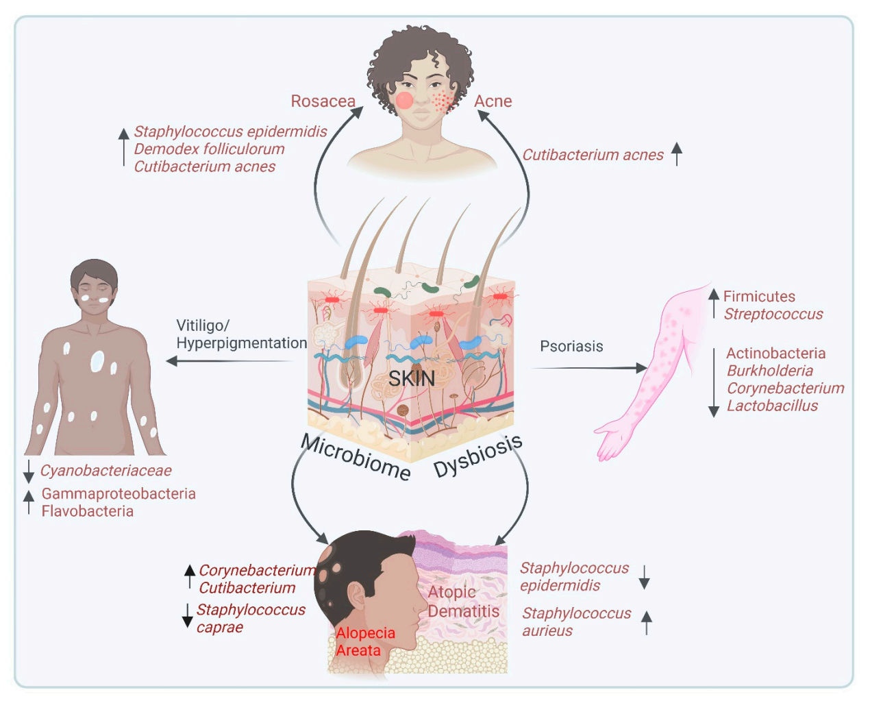 L'implication du microbiome cutané dans différents problématiques dermatologiques.