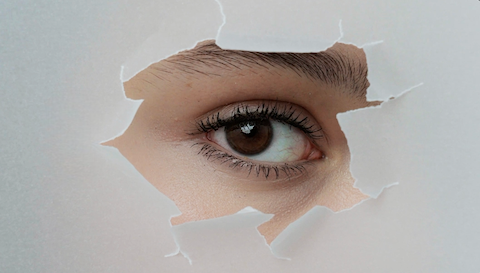Coup de soleil autour des yeux.