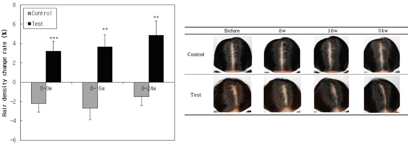 Effets de la caféine sur la pousse des cheveux.