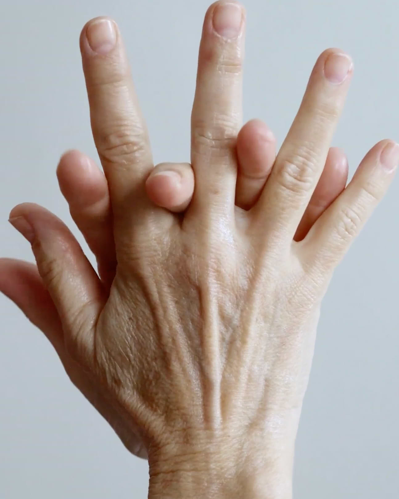 Prévention du vieillissement des mains.