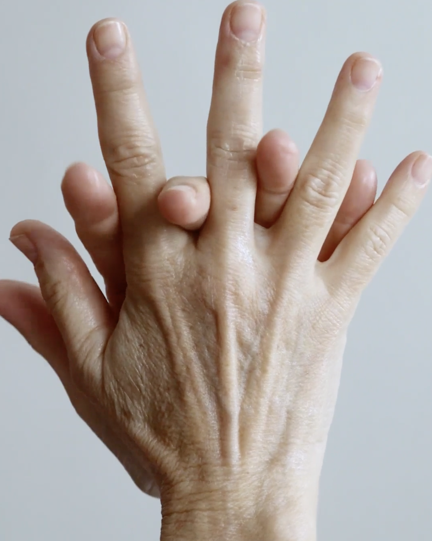 Prévention du vieillissement des mains.