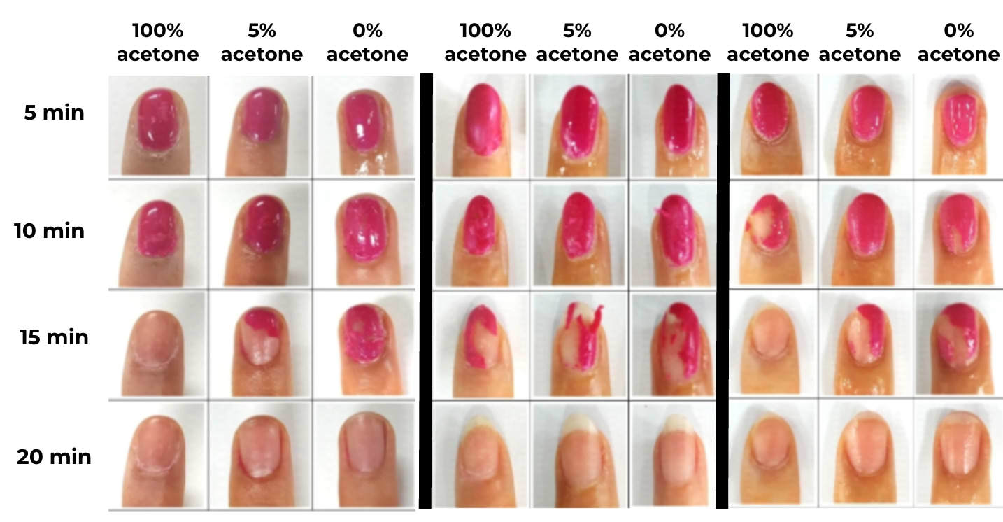 Morphologie des ongles après utilisation de dissolvants à différentes concentrations en acétone.
