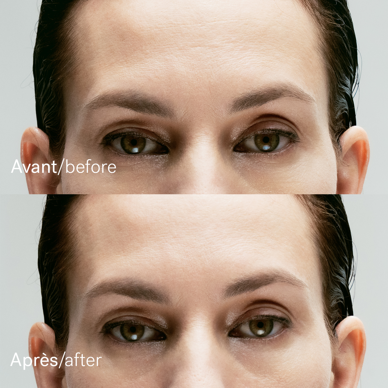 before_after_a43bis.jpg?