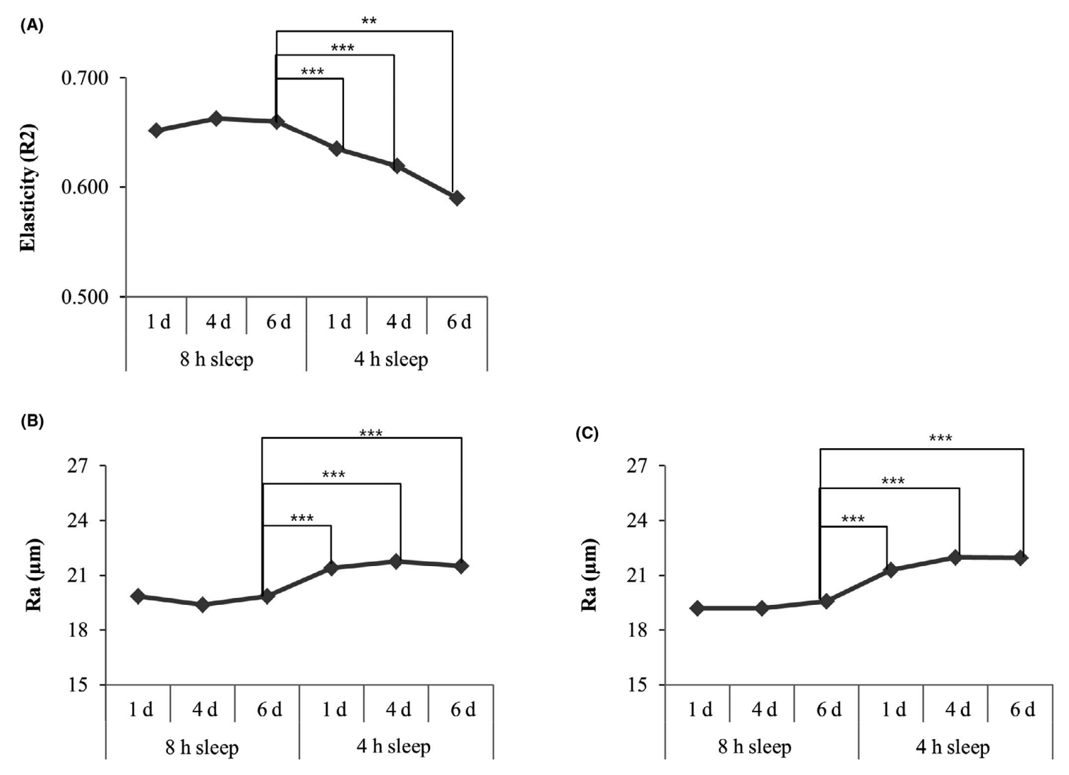 Les effets du manque de sommeil sur la peau : (A) élasticité de la peau, (B) rides du lion, (C) rides de la patte d'oie.