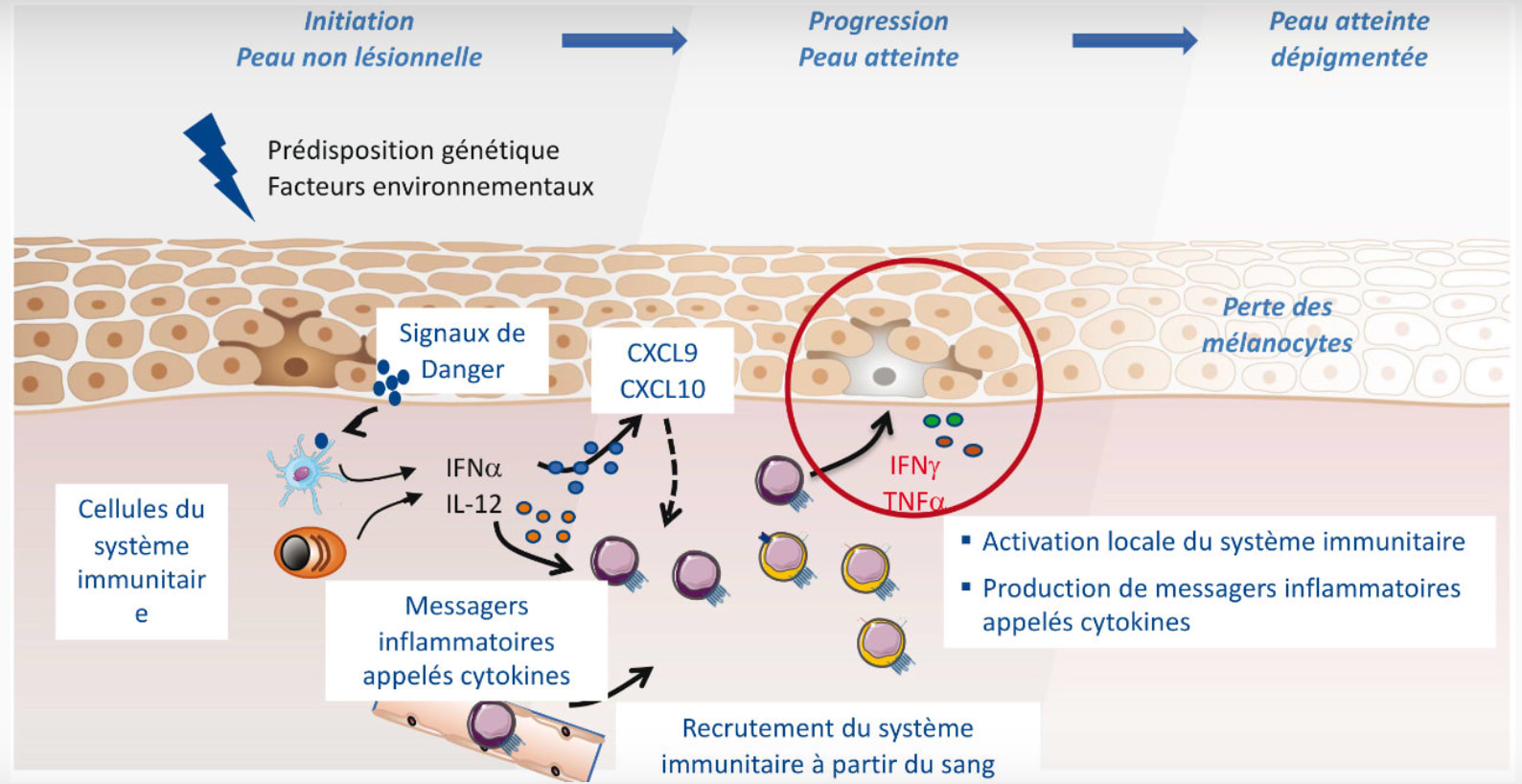 Mécanisme de défense du système immunitaire à l'origine du vitiligo.