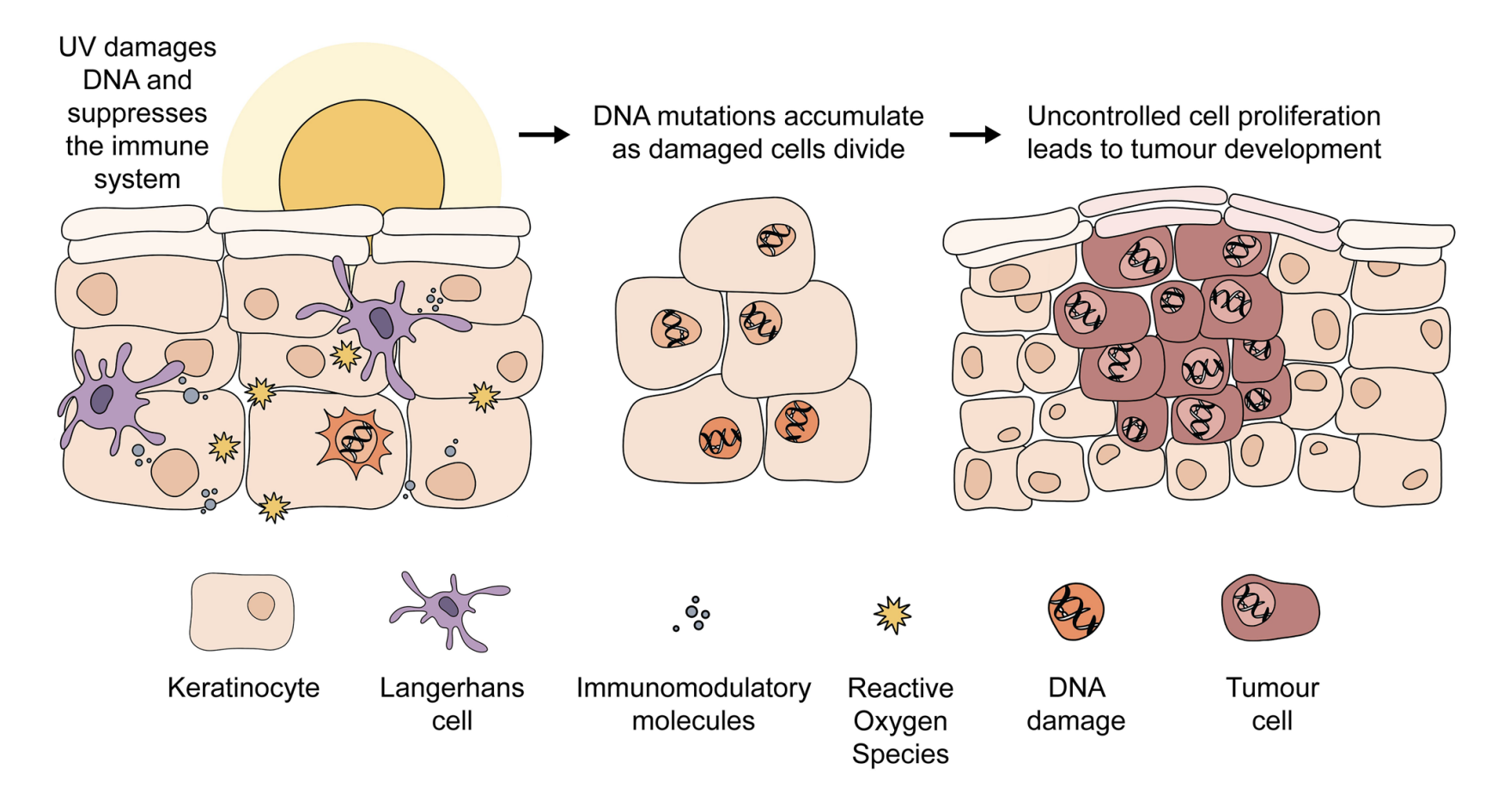 Le processus tumoral découle principalement d'une altération de l'ADN et du système immunitaire par les rayons UV.