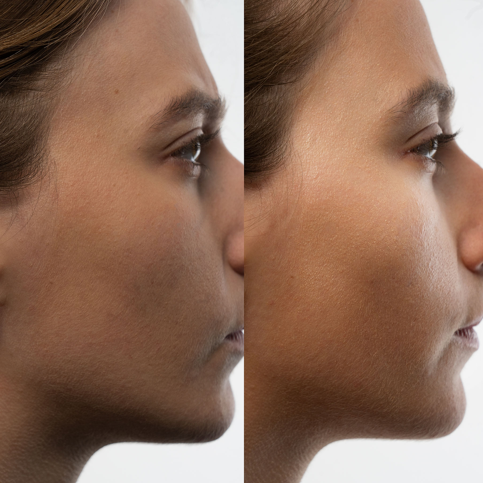 before_after3.jpg?speedsize=