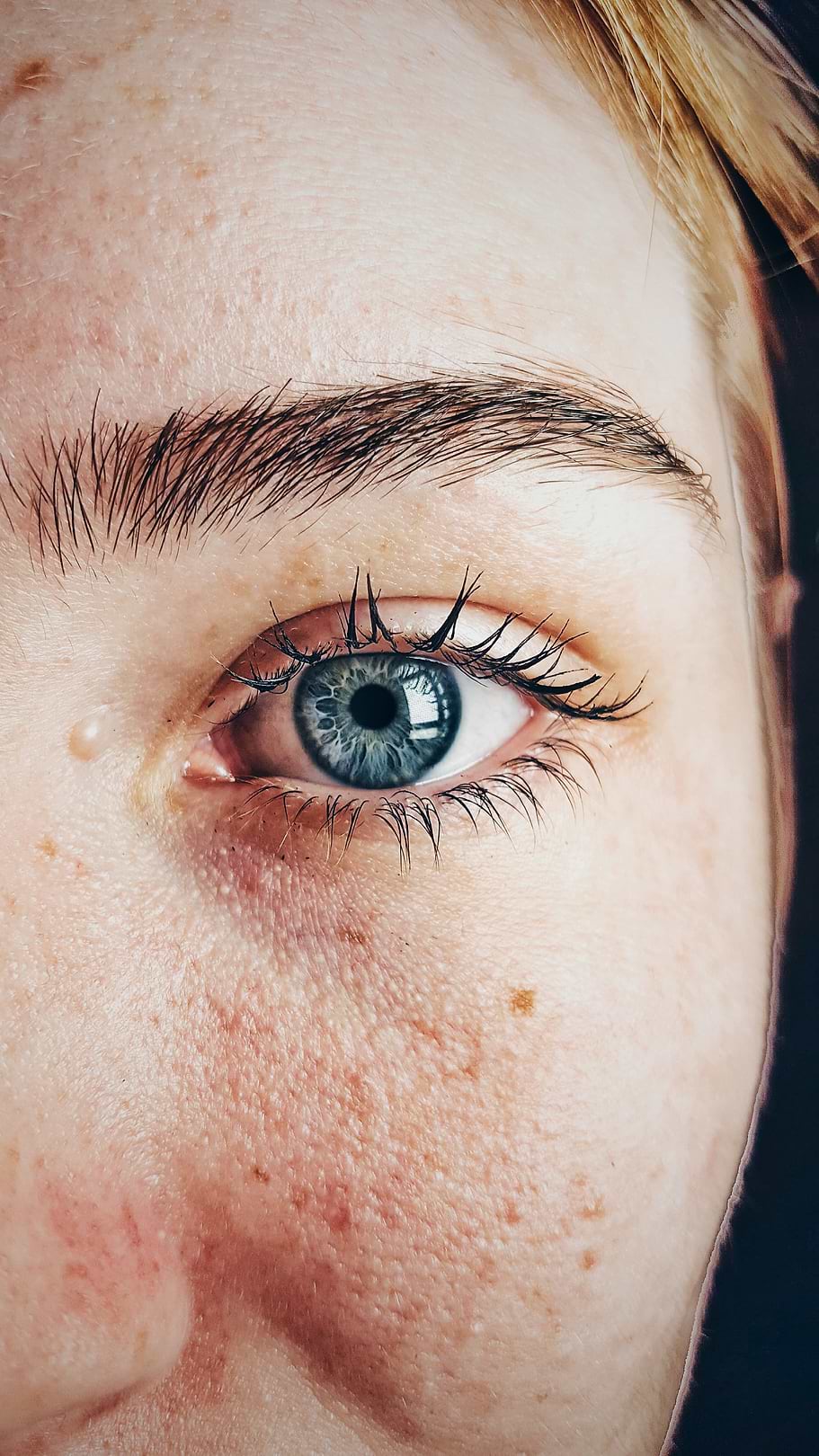 Tout savoir sur la photothérapie