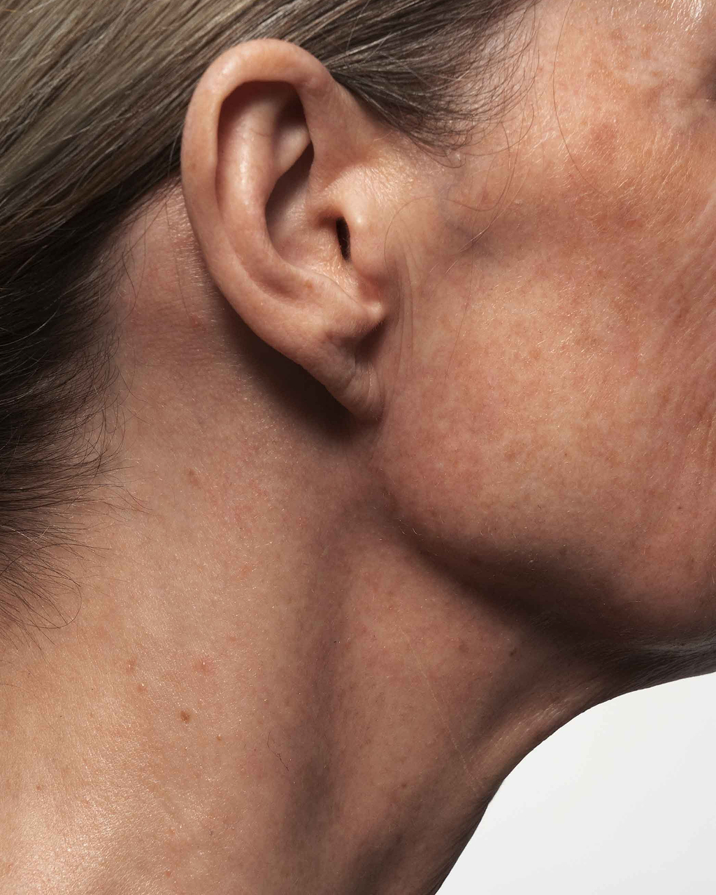 L'acide glycolique peut-il assécher la peau ?