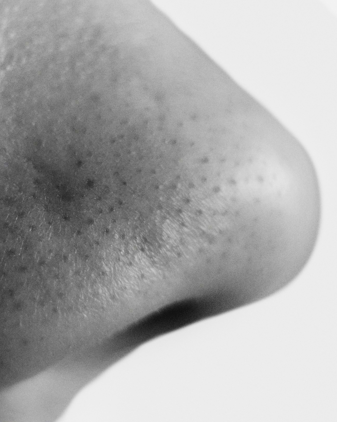 Comment éliminer les points noirs sur le nez ?