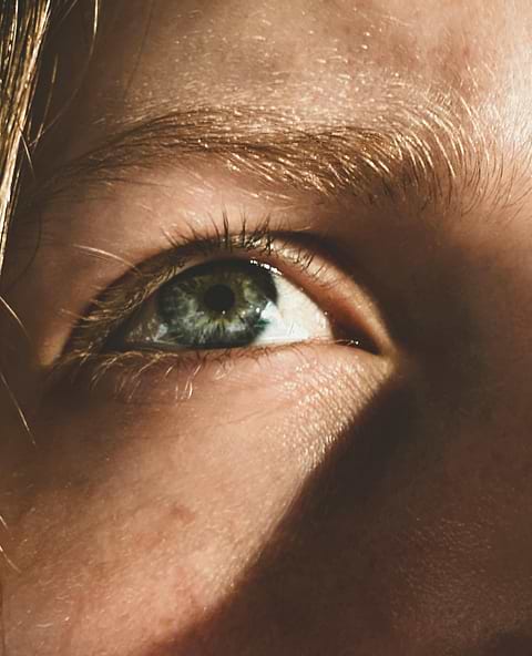 Causes et solutions pour les sourcils blancs.