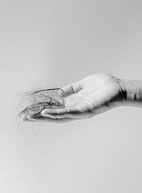 Chute de cheveux (alopécie)