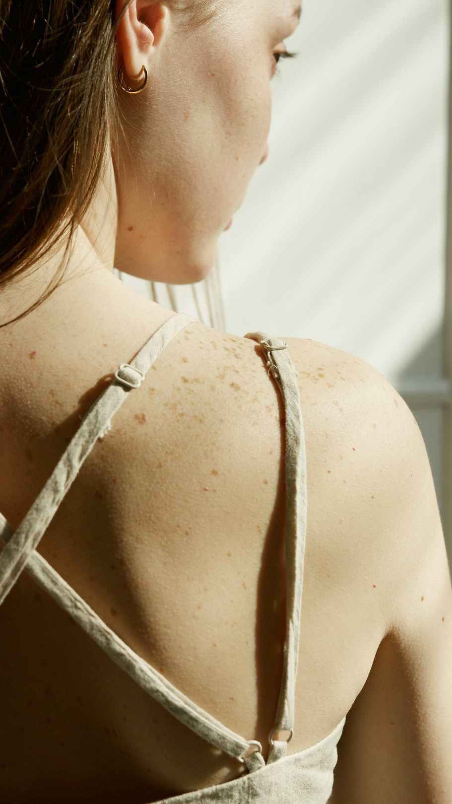 Comment calmer vos coups de soleil grâce à l'aloe vera ?