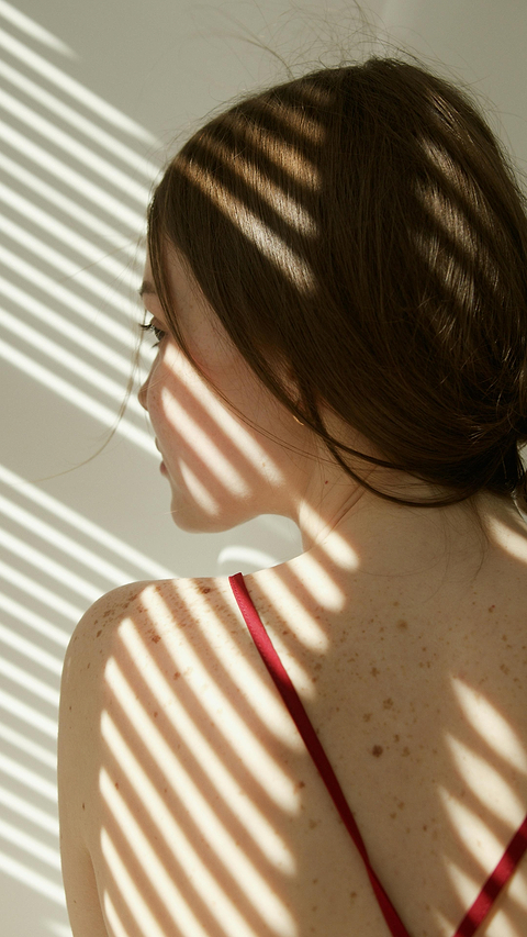 Effets des coups de soleil sur la peau.
