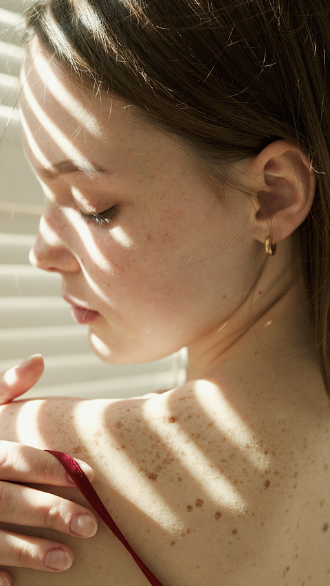 Différence grain de beauté et mélanome.