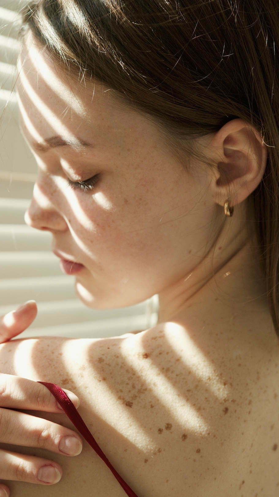 Psoriasis en été.