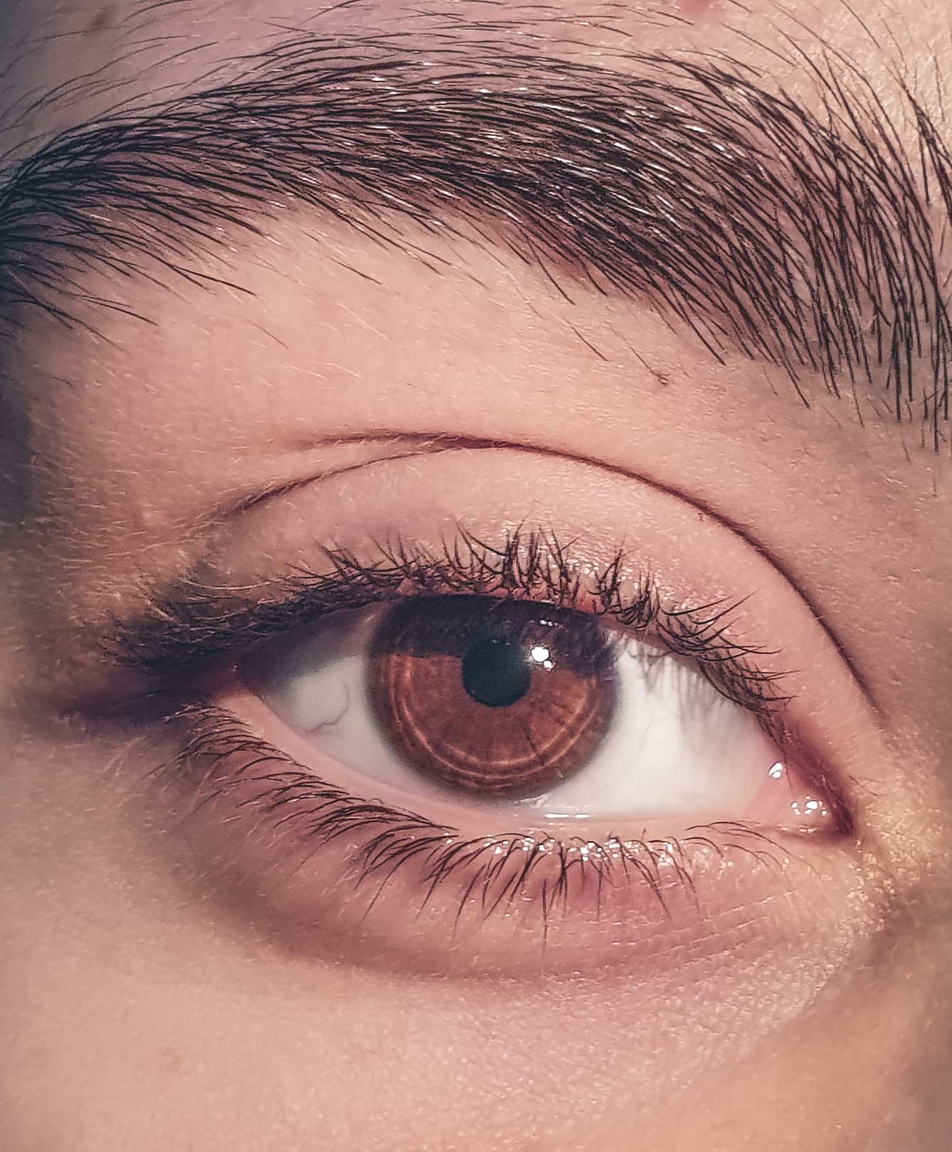 Solutions eczéma des yeux et des paupières.