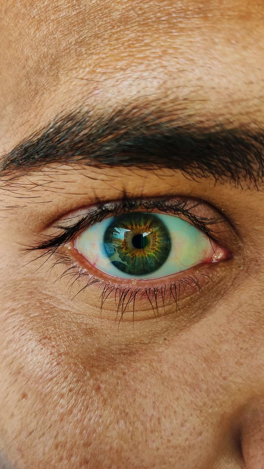 Prévenir apparition poches sous les yeux.