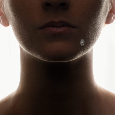 Causes apparition pustules.
