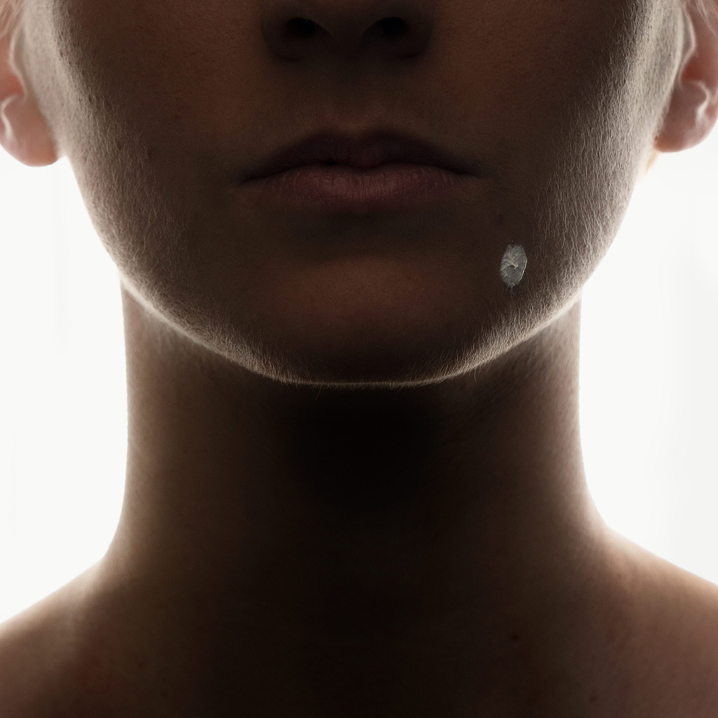 Causes apparition pustules.