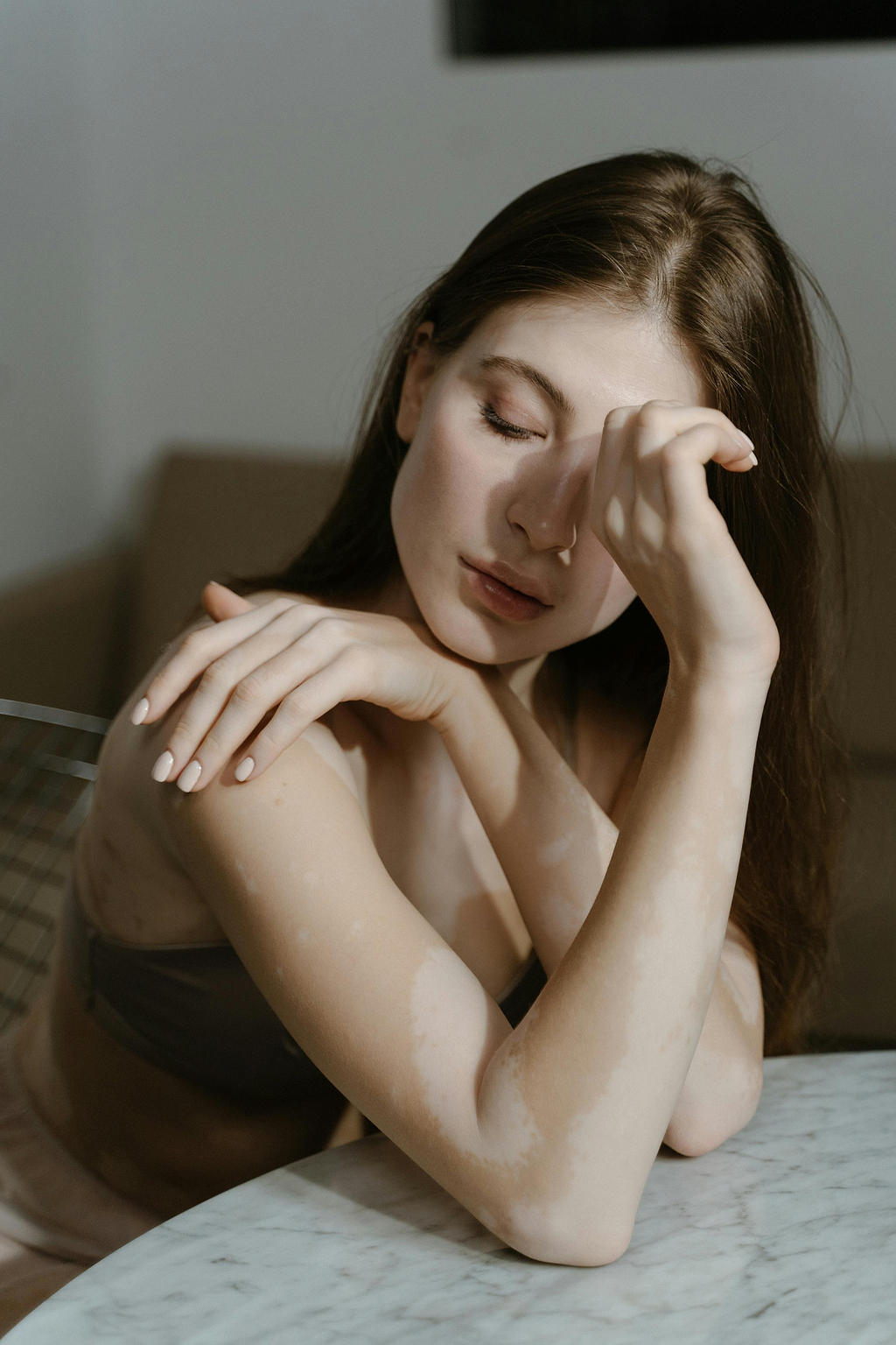 Les traitements du vitiligo des lèvres.