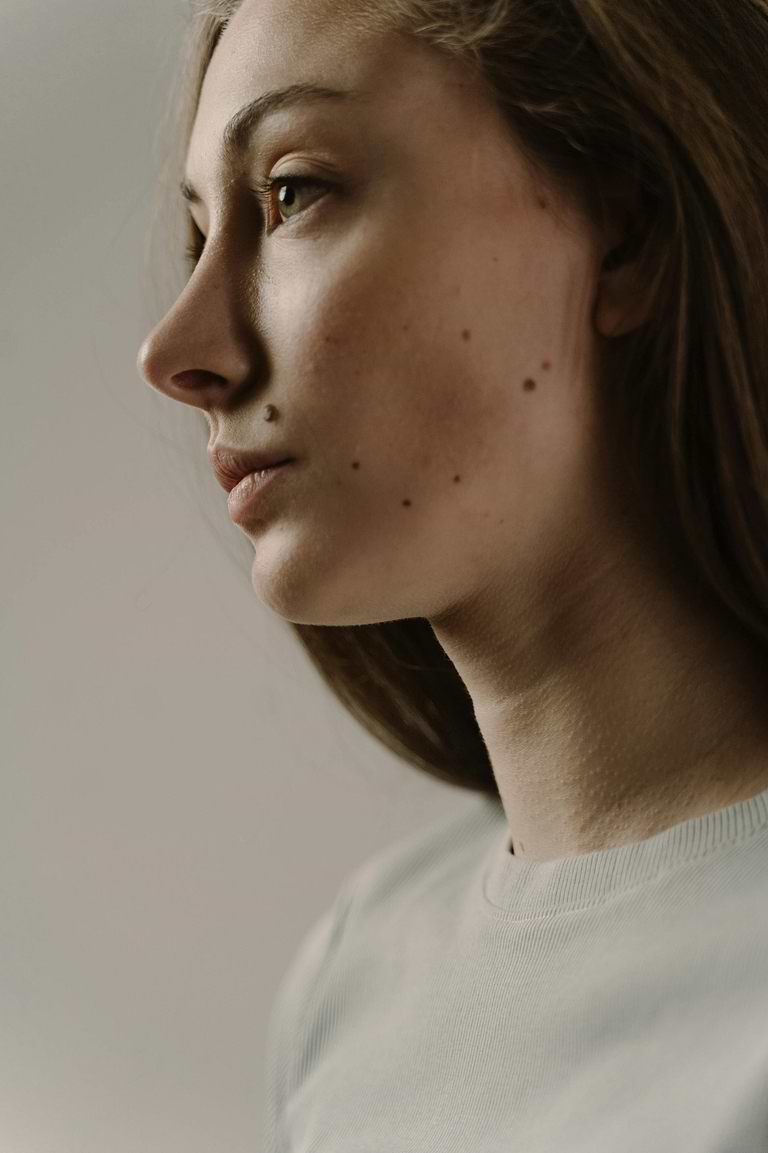 Le Roaccutane pour affiner le nez.