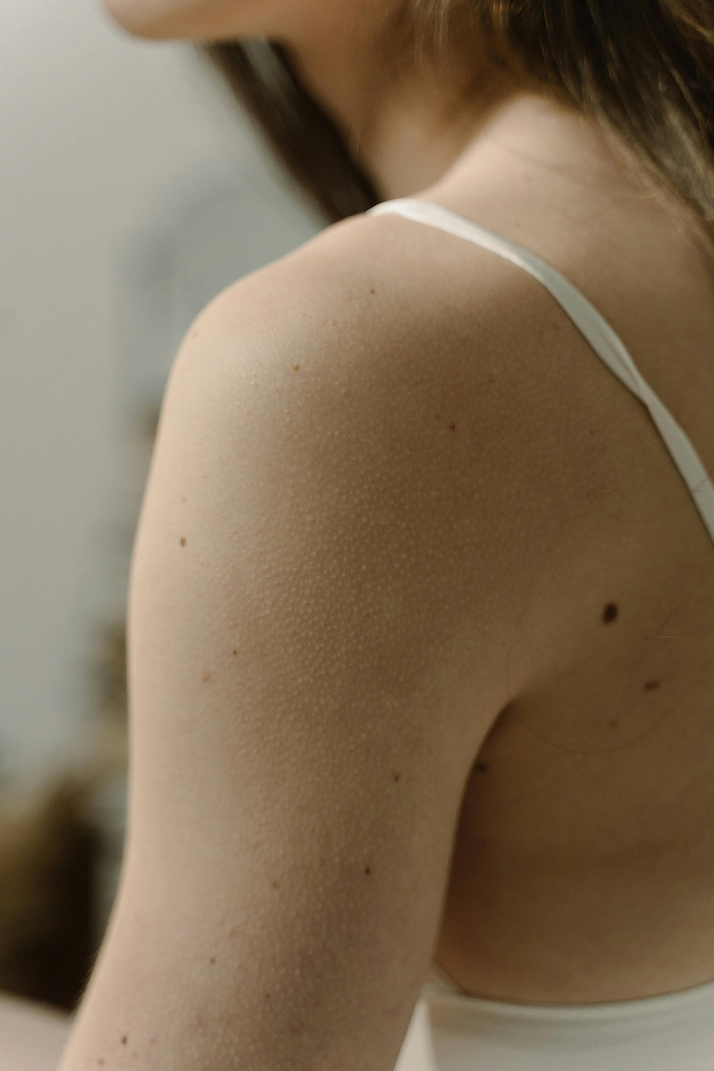 Différencier les boutons d'allergie.