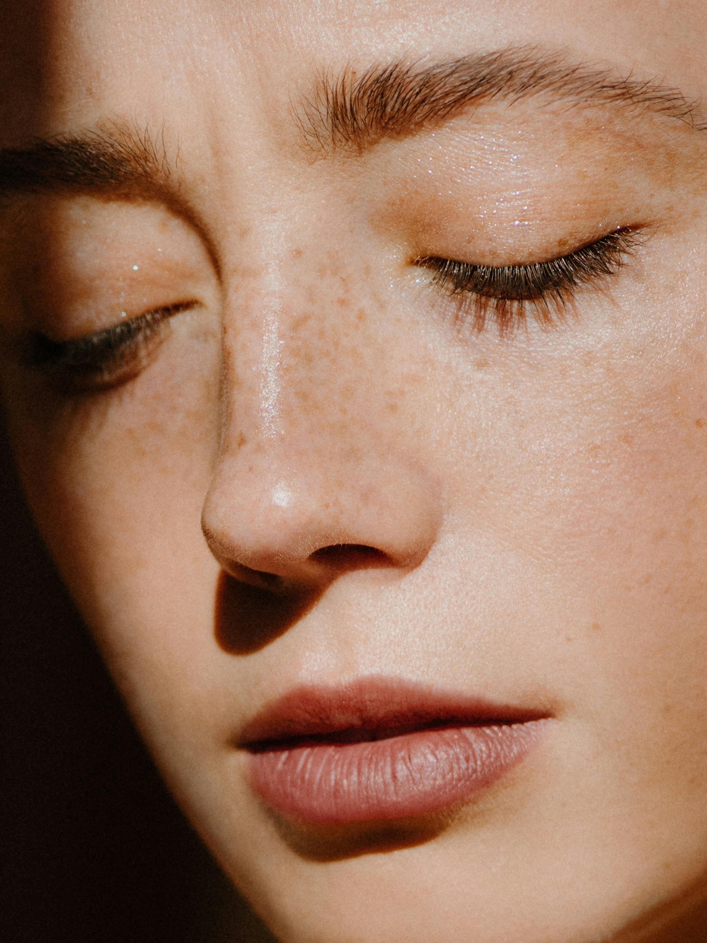 Vitamine E et acné