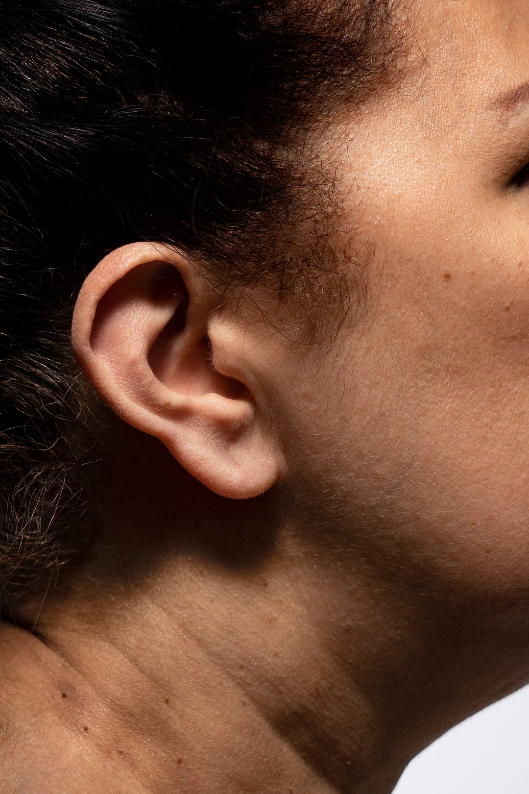 Comment reconnaître les différents types d'imperfections ?