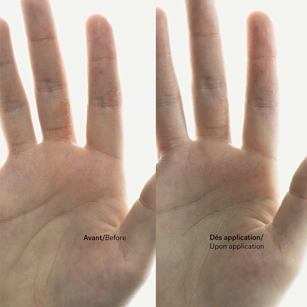 Crème Anti-Démangeaisons  Énoxolone 0,15% + Bisabolol — Typology