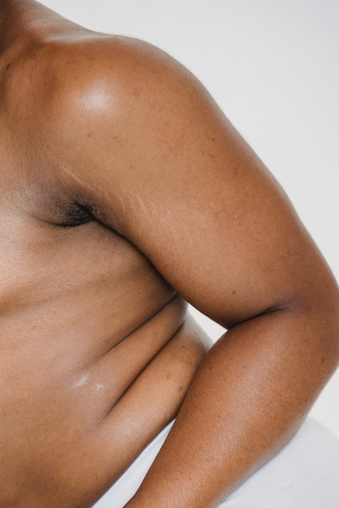 Huile de ricin et cellulites.
