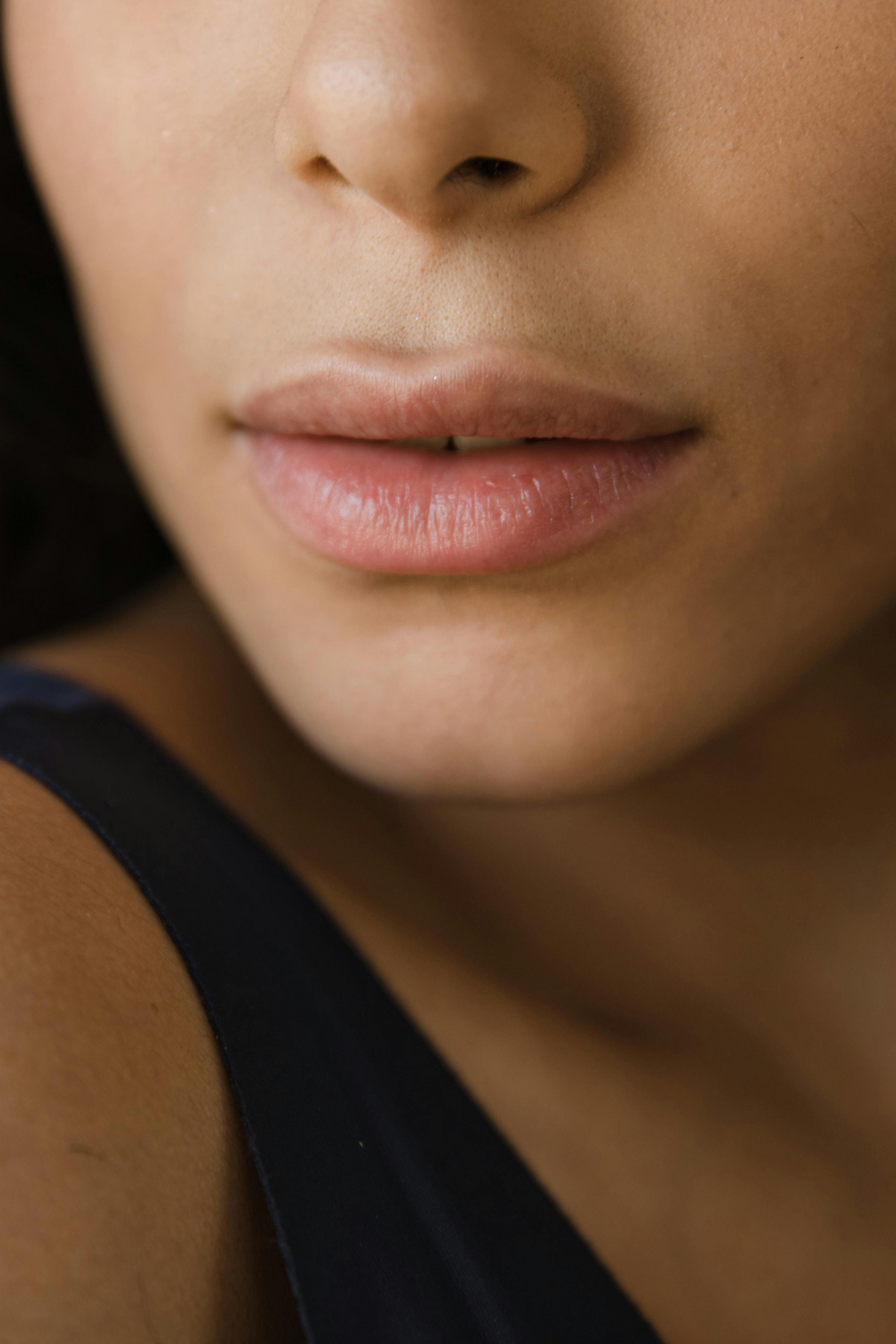 Informations sur les boutons de fièvre.