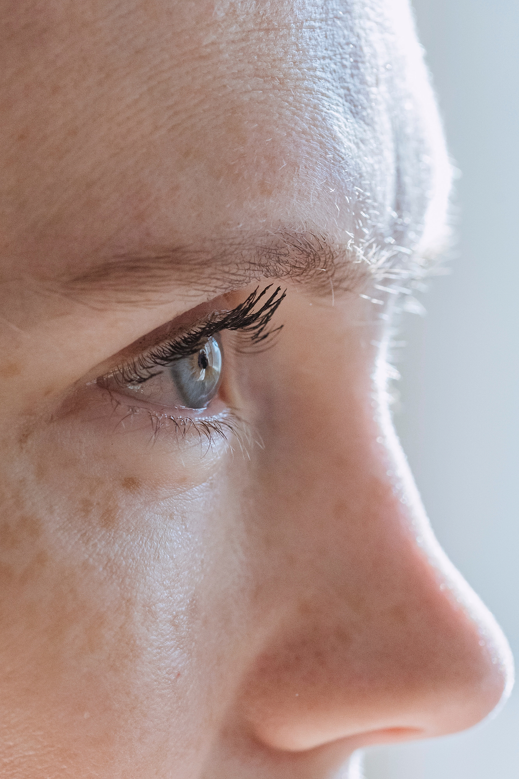 Une peau sensible est-elle toujours synonyme de peau sèche ?