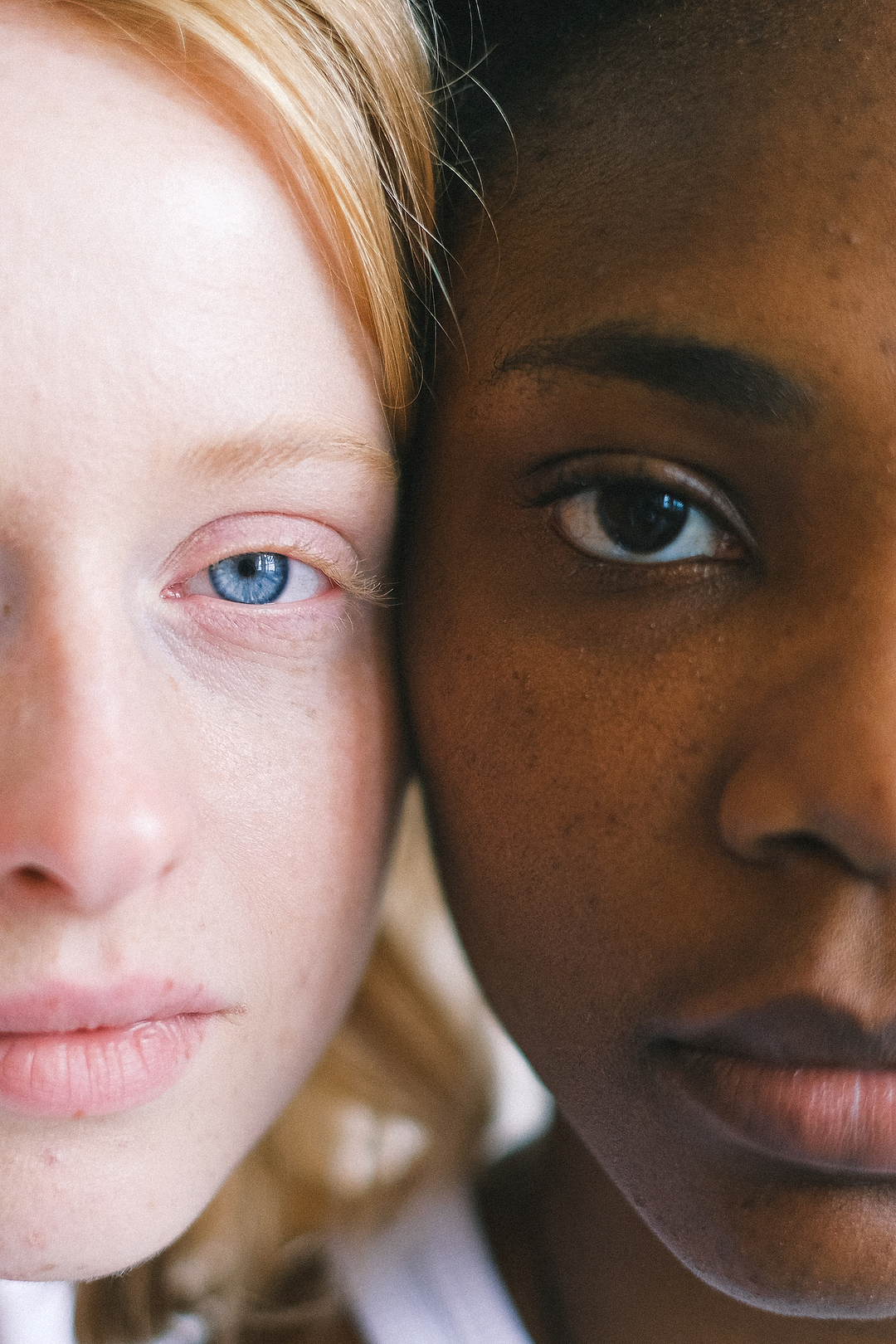 Couleur de peau et eczéma.